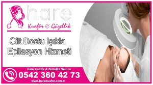 Ankara Keçiören buz lazer epilasyon